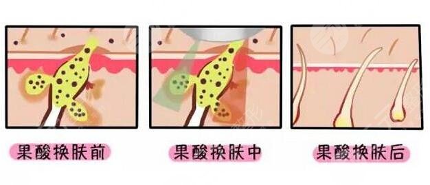  <p style="text-align: center;"> 	<span style="color:#ff0000;"><strong>【想變美嗎？預(yù)約醫(yī)生 獲取優(yōu)惠 點擊 &rarr;咨詢&larr;】</strong></span></p>