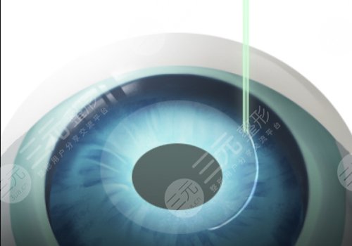 濟(jì)南市眼科醫(yī)院和山東省眼科醫(yī)院哪個好