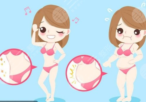 鄭州天后陳三群吸脂