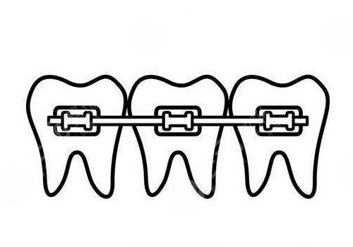 廈門(mén)市中醫(yī)院牙齒矯正價(jià)格多少錢(qián)