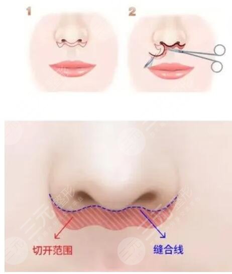 北京張曼美容醫(yī)生怎么樣？個(gè)人資料，擅長(zhǎng)唇部整形與人中縮短手術(shù)