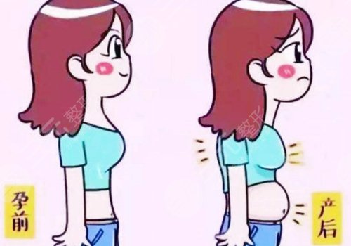 上海時(shí)光整形外科醫(yī)院腹壁成形術(shù)多少錢