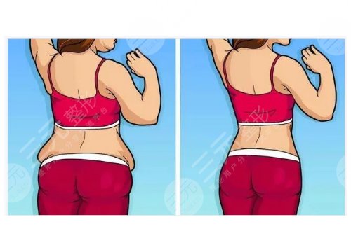 上海時(shí)光整形外科醫(yī)院腹壁成形術(shù)多少錢