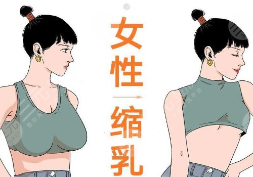 縮胸手術(shù)真實(shí)案例前后對(duì)比圖案例分享