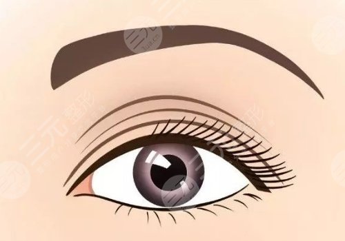 廈門海峽做雙眼皮那個(gè)醫(yī)生好