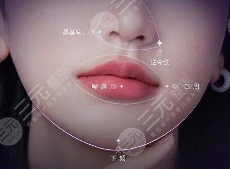 psv面部提升是拉皮嗎？是什么一種技術(shù)？和拉皮的區(qū)別大嗎？