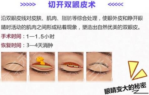 什么年齡割雙眼皮好？整形小課堂分享，術(shù)前你需要知道的4件事！