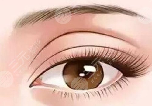 馮傳波雙眼皮修復(fù)案例