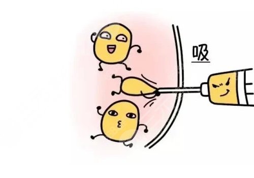 敖健飛做雙眼皮修復怎么樣