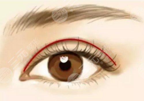 新鄉(xiāng)市中心醫(yī)院雙眼皮手術(shù)價(jià)格