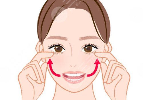 人工韌帶提升面部下垂安全嗎