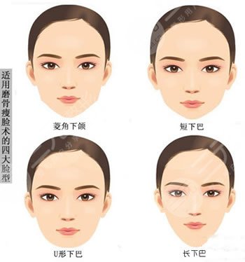 邱立東醫(yī)生做磨骨案例分享