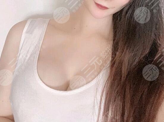 水滴型假體隆胸前后對(duì)比效果圖片和手術(shù)過程分享，小白隆胸避坑！