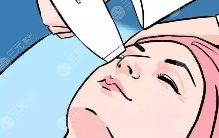 上海第九人民醫(yī)院整復(fù)外科除皺針案例