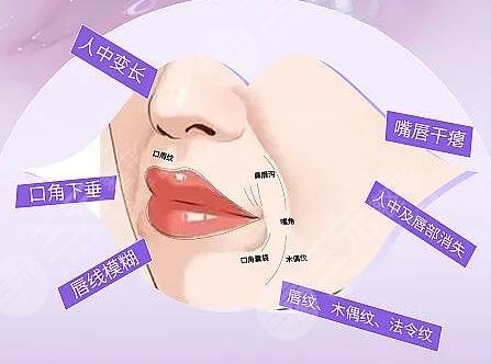 人工韌帶提升面部下垂安全嗎？多久能恢復(fù)？效果可以維持多長(zhǎng)時(shí)間？