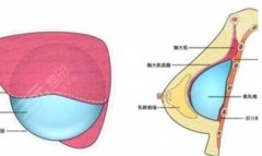 內(nèi)窺鏡隆胸和普通隆胸有什么區(qū)別？技術(shù)優(yōu)勢(shì)對(duì)比講解，教你選擇！