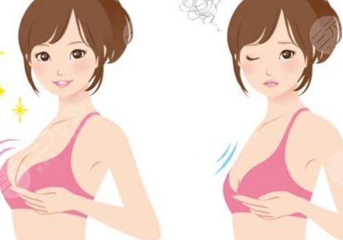 辛敏強(qiáng)隆胸收費價目表