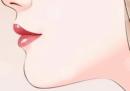 整容下巴需要花費(fèi)多少錢呢