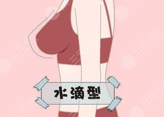 水滴形豐胸