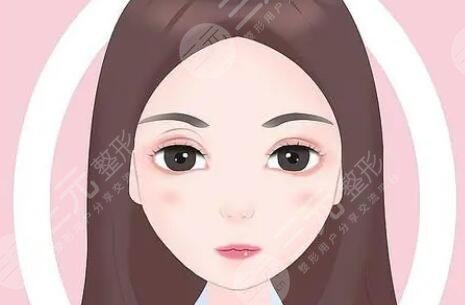 雙眼皮修復(fù)