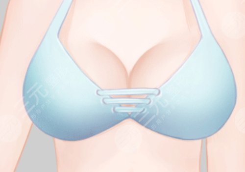 乳房下垂上提手術(shù)大約多少錢