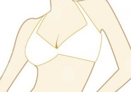 八大處辛敏強(qiáng)乳房下垂手術(shù)