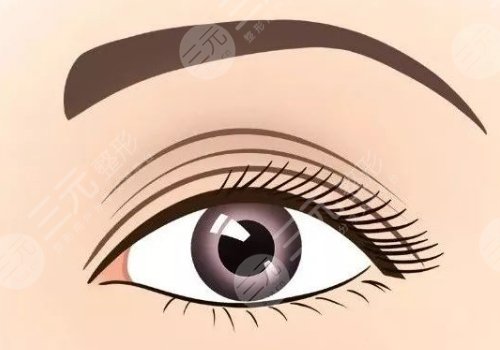 武漢付冰川雙眼皮如何