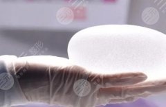 隆胸假體牌子前十名？詳細(xì)品牌圖大放送