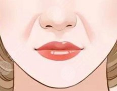 打法令紋一般需要幾支玻尿酸？打法令紋要注意什么