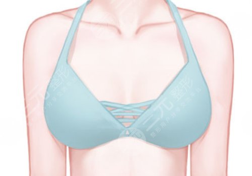 上海九醫(yī)院徐華和王濤乳房再造哪個(gè)好