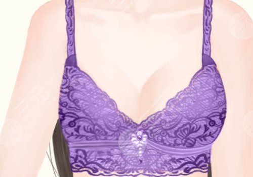 自體脂肪豐胸可以維持多長(zhǎng)時(shí)間