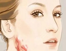 面部疤痕整形手術(shù)費用是多少？如何選擇合適的醫(yī)院？參考價格為5000元起