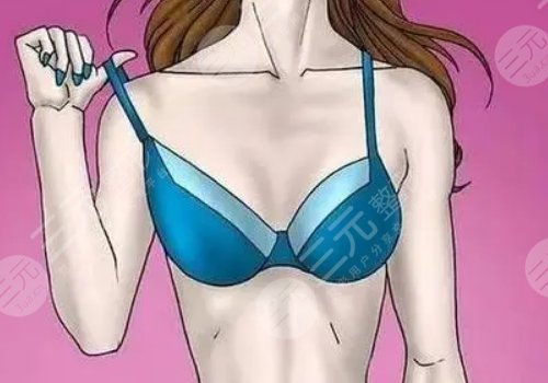 大胸下垂可以做縮胸手術嗎