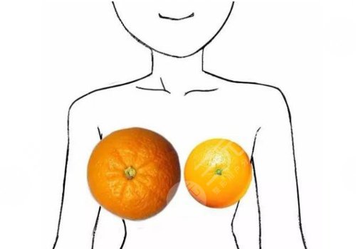 徐醫(yī)附院縮胸手術(shù)費(fèi)用