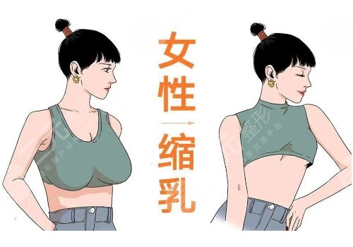 樂(lè)山人民醫(yī)院縮胸手術(shù)費(fèi)用