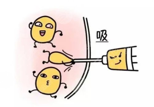 上海十院減重手術(shù)多少錢