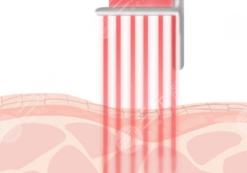 上海九院除皺價格