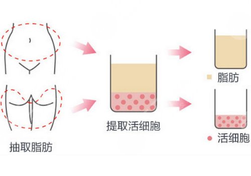 深圳富華醫(yī)療美容醫(yī)院院長