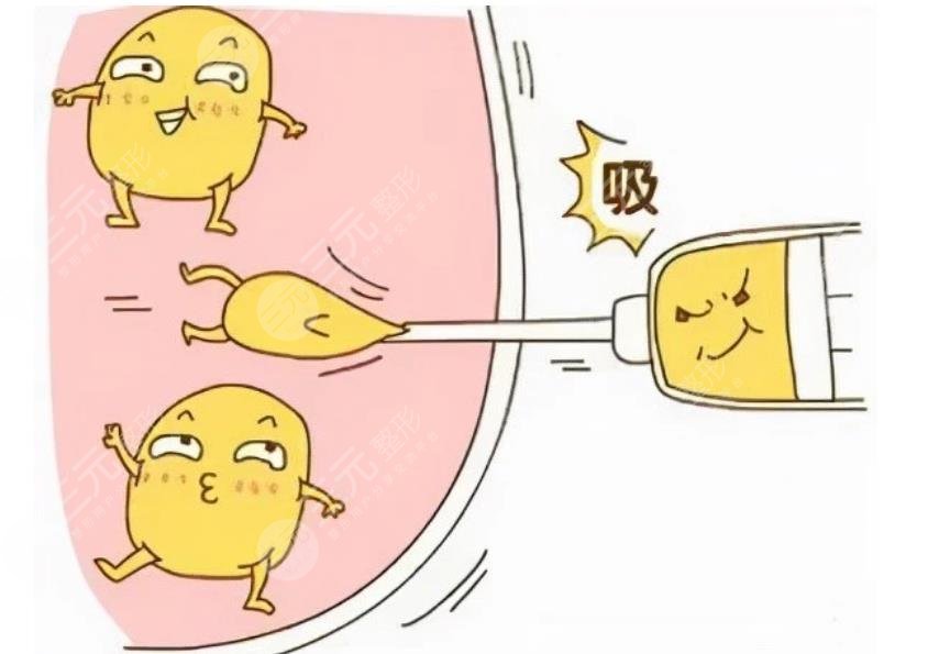 王仁根醫(yī)生吸脂塑形案例