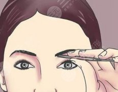 打眉弓有什么好處？術(shù)后護(hù)理方式一覽