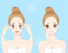 面部提升做什么項(xiàng)目好？注射美容/手術(shù)除皺等都很不錯(cuò)