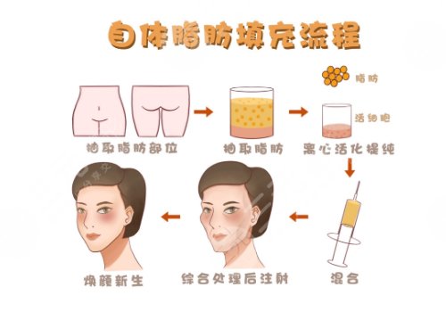 成都潤(rùn)美玉之光醫(yī)療美容正規(guī)嗎