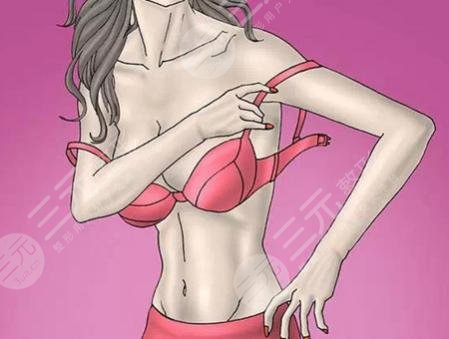 瀘州醫(yī)學院附屬醫(yī)院整形美容科假體隆胸案例