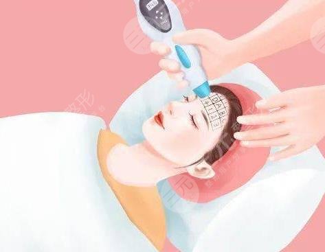 熱瑪吉一般打多少發(fā)？抗衰王道，沒那么簡單！術(shù)前這些你得知道~