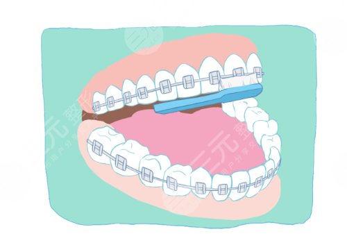 汕頭奧詩卡口腔醫(yī)院怎么樣