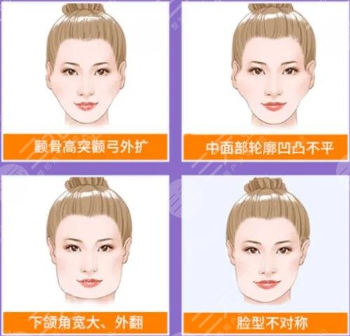 顴骨磨骨手術(shù)過(guò)程科普！頜面整形不簡(jiǎn)單，術(shù)前知識(shí)點(diǎn)掃盲！