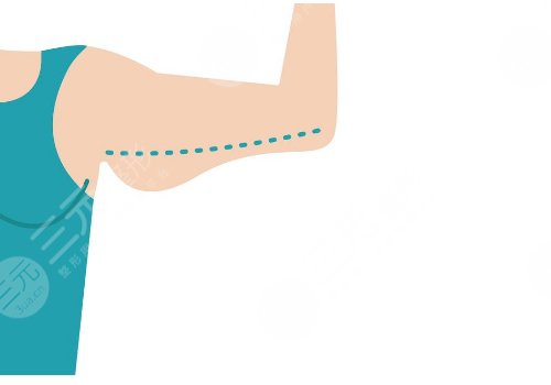 汕頭市中心醫(yī)院整形吸脂多少錢