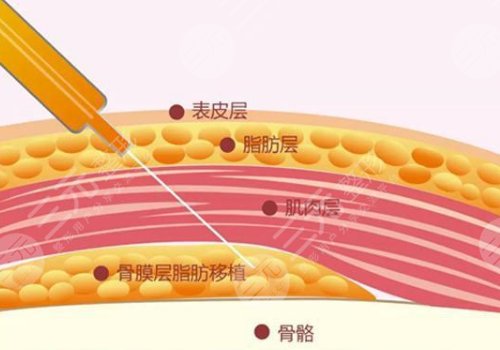 整容下巴多少錢(qián)
