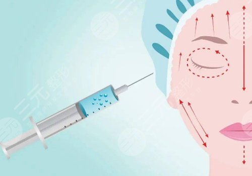 非手術(shù)整形美容