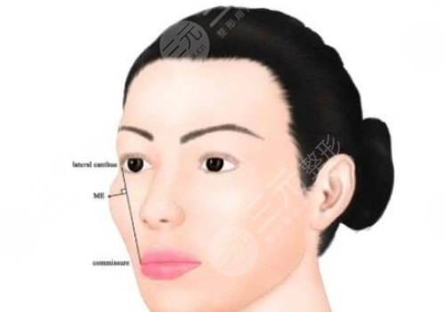 顴骨手術(shù)費用一般多少